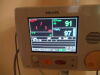 PHILIPS C-1 Monitor