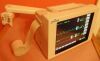 SPACELABS 90367 Monitor