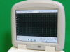 PHILIPS PAGEWRITER TOUCH EKG