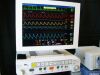 DRAEGER Tiro Anesthesia Machine
