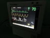 WELCH ALLYN PROPAC CS ICU/CCU