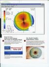 TOPCON KR 8000PA Topographer
