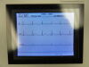 GE MAC 1200 EKG