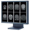 NEC MD21GS-2MP Display Monitor