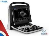 CHISON Eco 3 Ultrasound - Shared Service