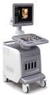 CHISON I7 Ultrasound - Shared Service
