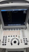 CHISON ECO3 BW Scanner
