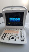 CHISON ECO3 BW Scanner