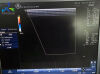 GE 12L-RS Ultrasound Transducer