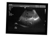 PHILIPS 3D8-4 Ultrasound Transducer