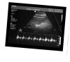 PHILIPS 3D8-4 Ultrasound Transducer