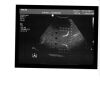 PHILIPS 3D8-4 Ultrasound Transducer