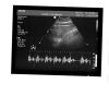 PHILIPS 3D8-4 Ultrasound Transducer