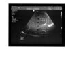 PHILIPS 3D8-4 Ultrasound Transducer