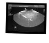 PHILIPS 3D9-3v Ultrasound Transducer