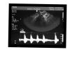 PHILIPS 3D9-3v Ultrasound Transducer