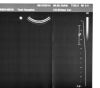 PHILIPS C8-5 Ultrasound Transducer