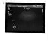 PHILIPS C8-5 Ultrasound Transducer Wanted