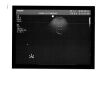 PHILIPS C8-5 Ultrasound Transducer Wanted