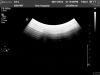 PHILIPS C5-2 Ultrasound Transducer