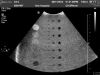 PHILIPS C5-2 Ultrasound Transducer