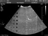 PHILIPS C5-2 Ultrasound Transducer