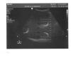 PHILIPS 3D6-2 Ultrasound Transducer