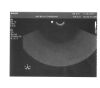 PHILIPS C8-4v Ultrasound Transducer