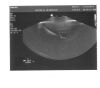 PHILIPS C8-4v Ultrasound Transducer