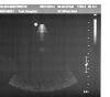 PHILIPS X7-2 Ultrasound Transducer