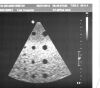 PHILIPS X7-2 Ultrasound Transducer