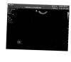 PHILIPS C9-3v Ultrasound Transducer