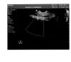 PHILIPS C9-3v Ultrasound Transducer