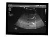 PHILIPS V6-2 Ultrasound Transducer