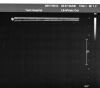 PHILIPS L8-4 Ultrasound Transducer