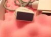 SIEMENS PH4-1 Ultrasound Transducer