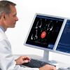 GE EchoPAC Echo PAC Ultrasound - Cardiac - Vascular