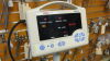 CAS MEDICAL 740 Monitor
