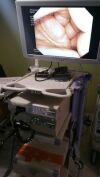OLYMPUS CV- 180