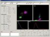ERBA Excell 2280 Hematology Analyzer