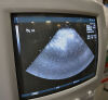 ACUSON 4v1-s Ultrasound Transducer