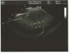 GE E8C Ultrasound Transducer