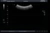 TOSHIBA PVT-375BT Ultrasound Transducer