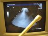 GE 618E Ultrasound Transducer