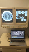 OEC 9400 C-Arm
