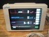 SPACELABS 90369 Monitor