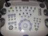 MEDISON X8 Ultrasound - OB / GYN