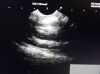 FUJINON EG-530UT Gastroscope