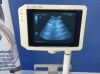 GE Logic cx 200 Ultrasound - OB / GYN