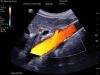 MINDRAY TE7 Touch Enabled Ultrasound - Shared Service